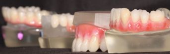 Implantate 1