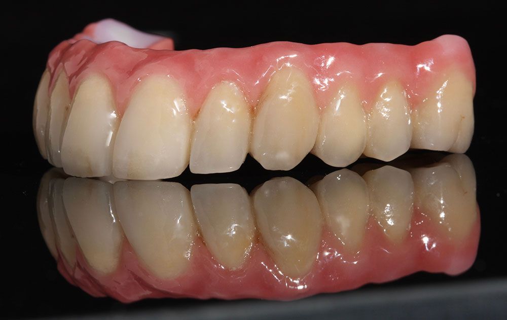 Implantate 2