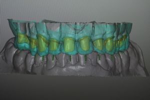 Digital-Line-04
